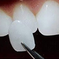 periodontia