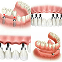 periodontia