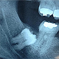 periodontia
