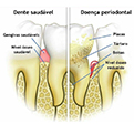 periodontia