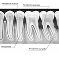 periodontia